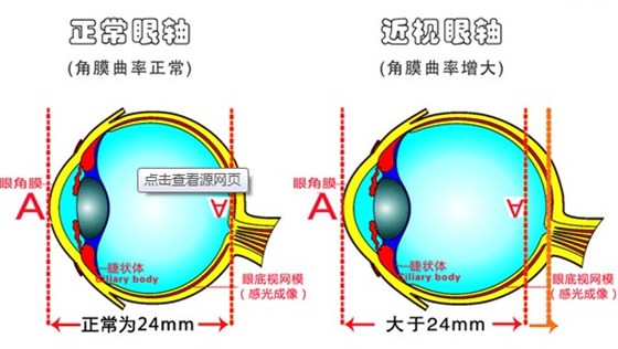 眼轴发展，永昌眼镜
