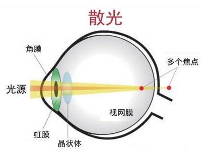 豪雅新乐学眼镜
