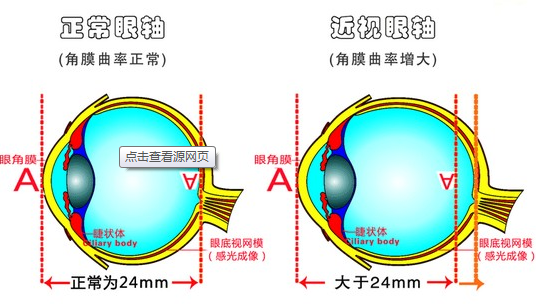 眼轴发展，永昌眼镜